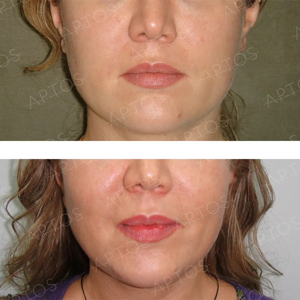 aptos-auri-przedipo-4